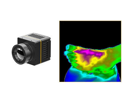 Sanità termica non raffreddata del modulo 384x288 17μM For Thermographic Medical